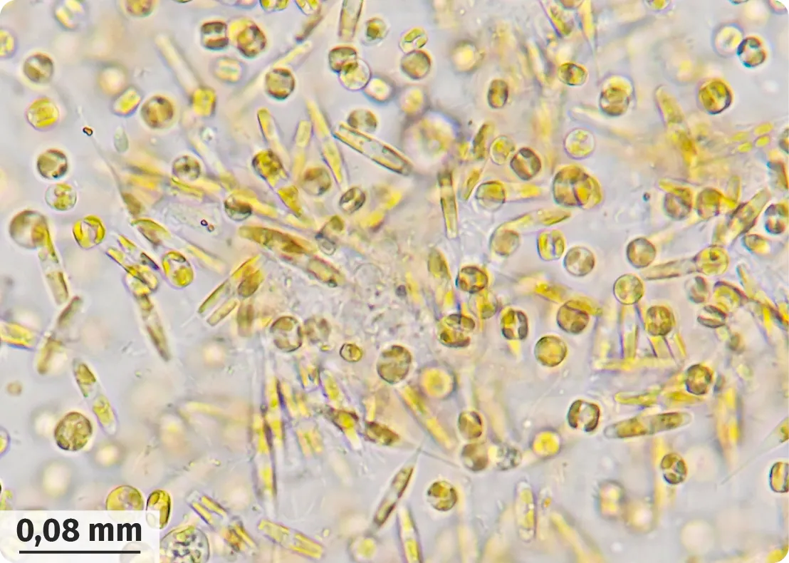 Micro-organismes au microscope, formes variées, certains allongés, d'autres ronds.