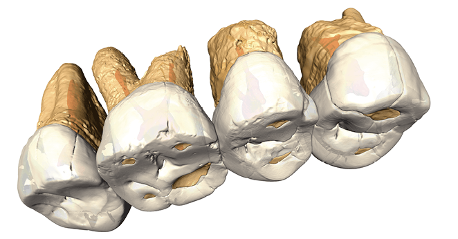 Dents d'Homo Luzonensis