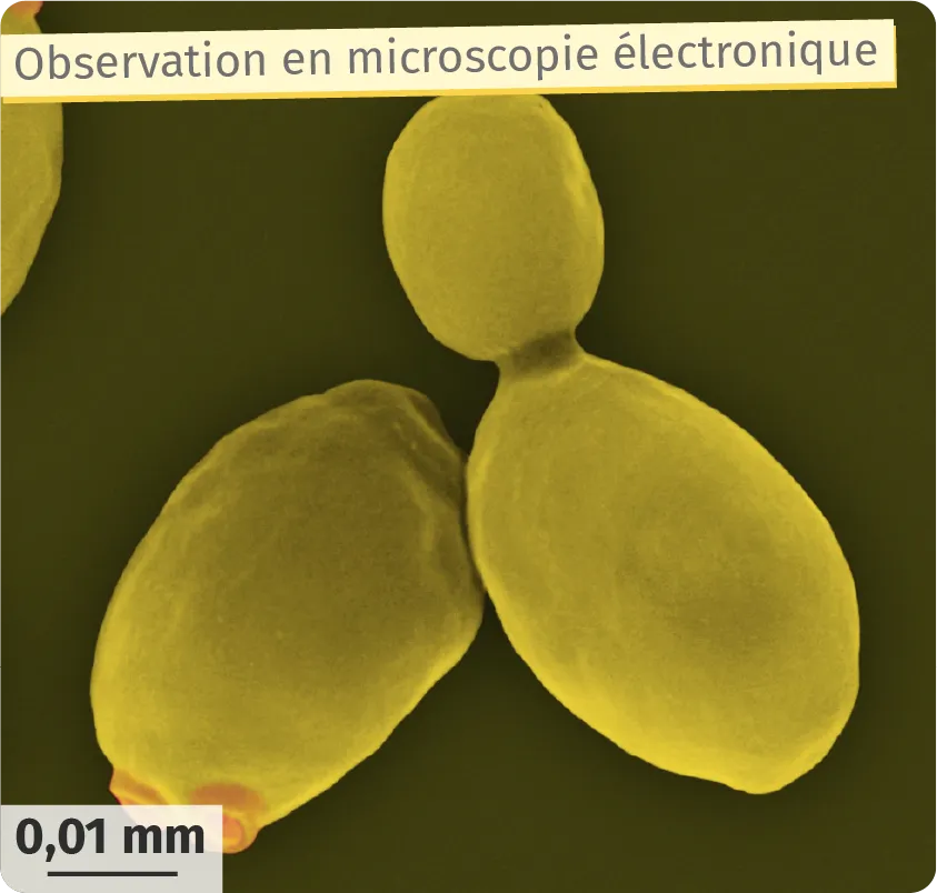 Observation en microscopie électronique