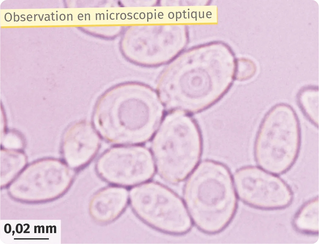 Observation en microscopie optique