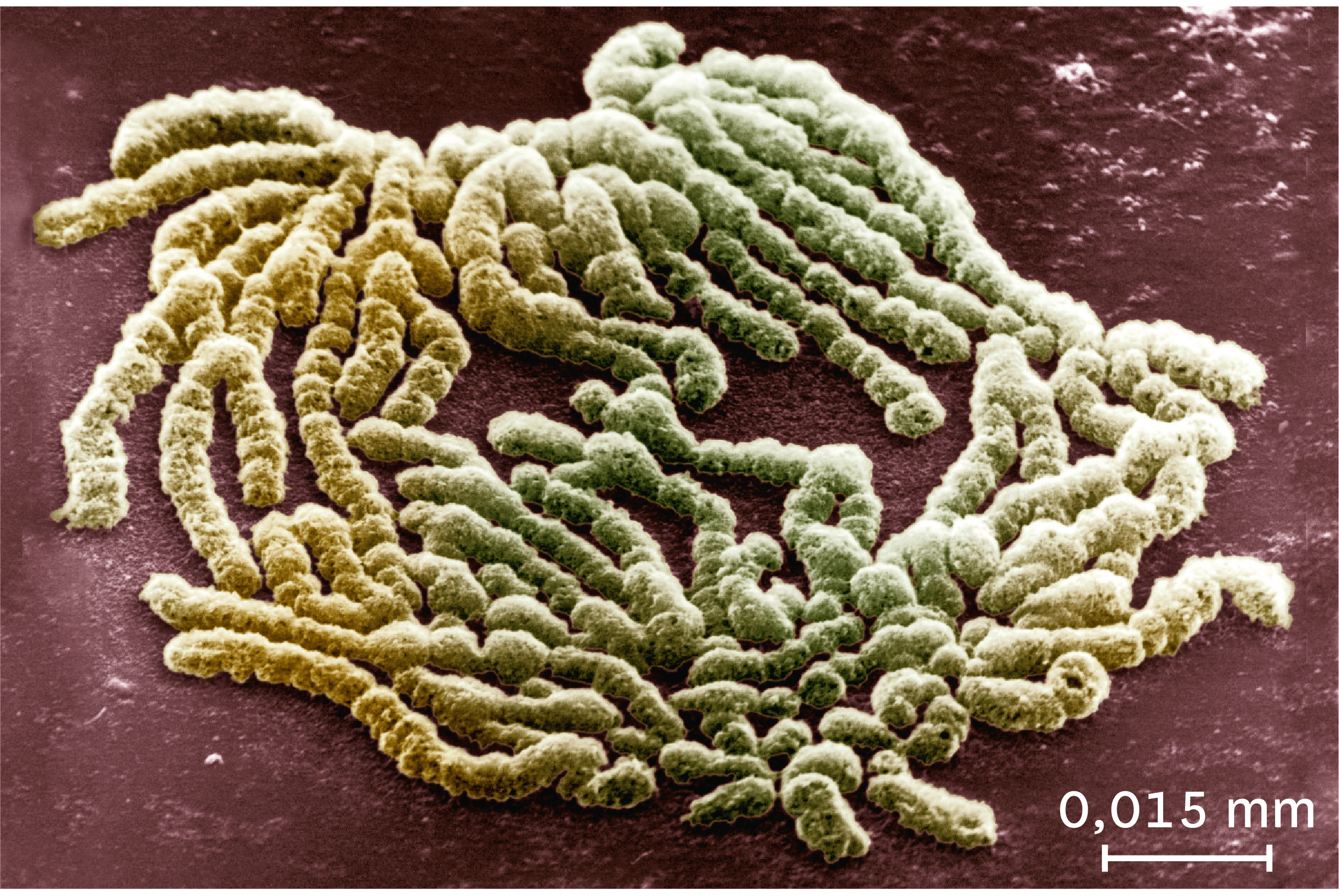 <stamp theme='svt-green1'>Doc. 6</stamp> Une observation au microscope électronique à balayage des chromosomes au milieu de la division cellulaire.