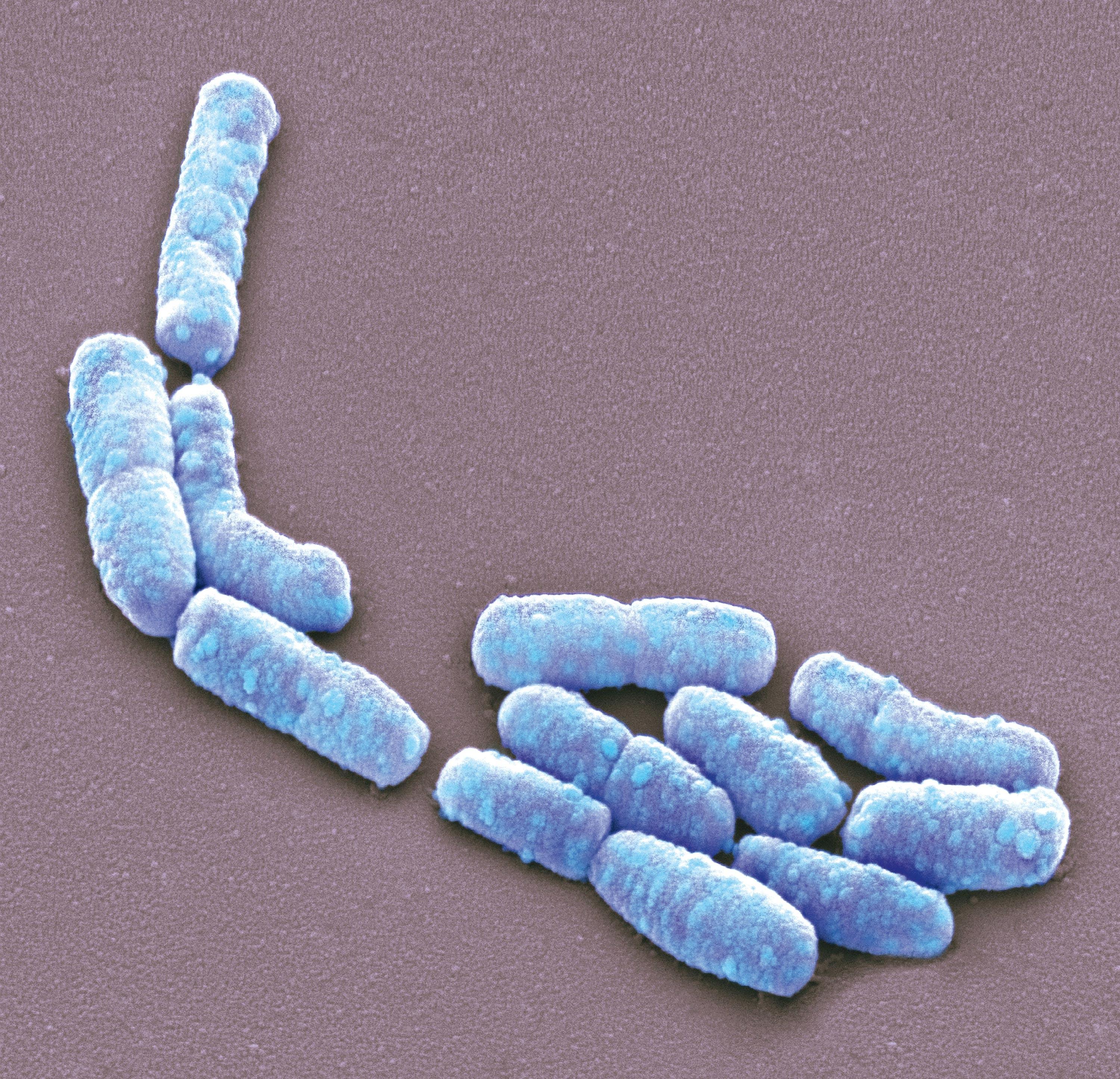 <stamp theme='svt-green1'>Doc. 2</stamp> Une observation au microscope électronique à balayage de bactéries présentes dans le tube digestif des mammifères, Escherichia coli (image colorisée).