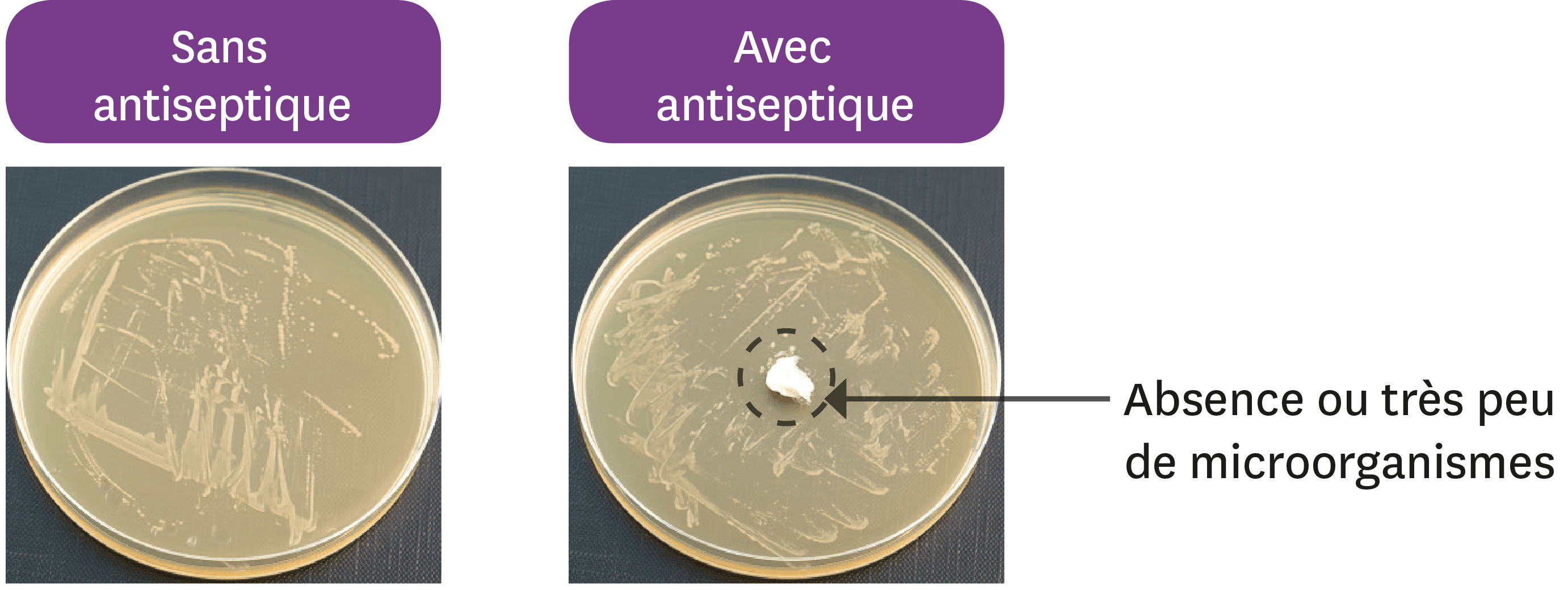 <stamp theme='svt-green1'>Doc. 5</stamp> L’effet d’un produit antiseptique, la chlorhexidine, sur la prolifération des microorganismes.