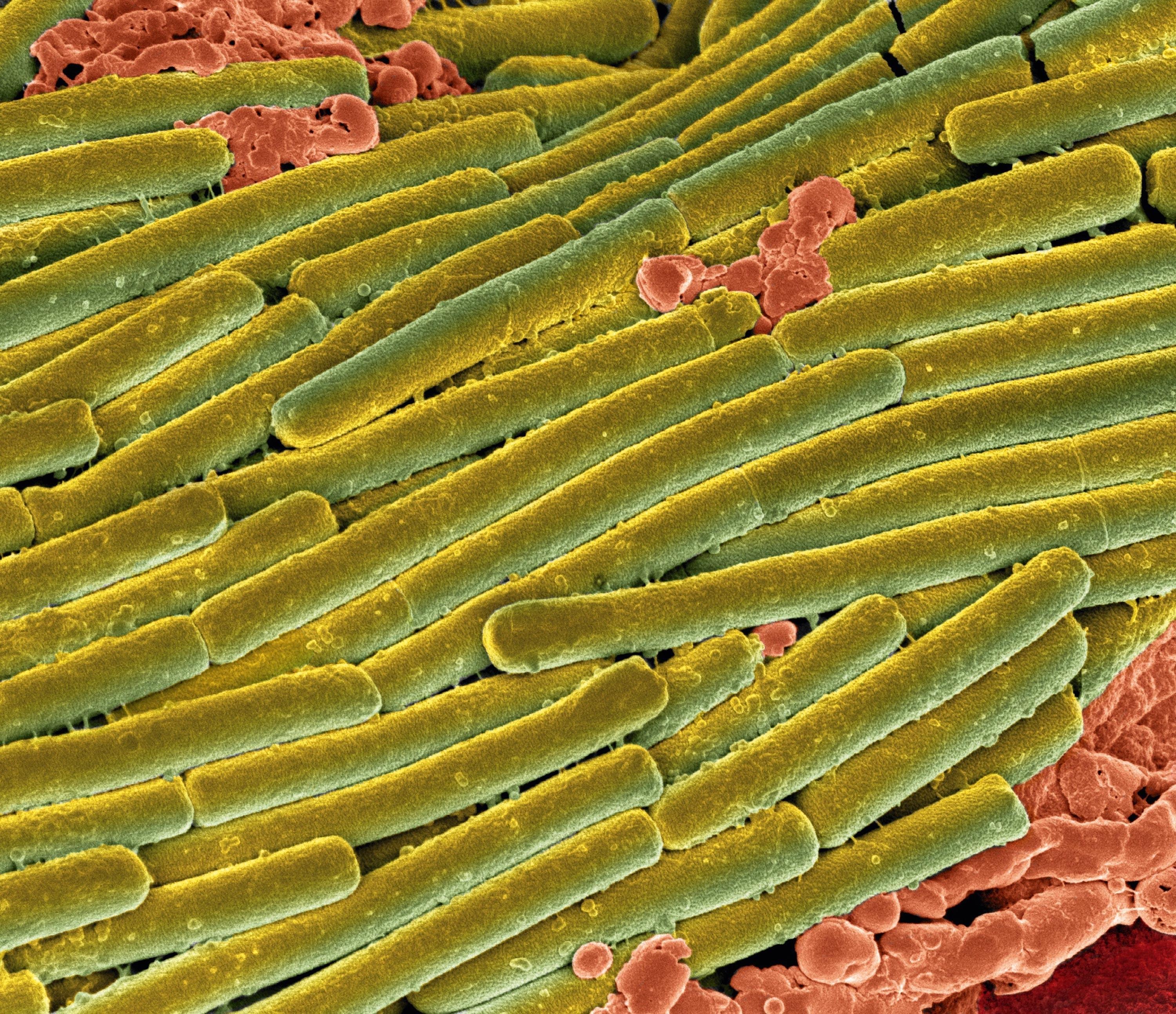 <stamp theme='svt-green1'>Doc. 3</stamp> Des bactéries Clostridium difficile (en vert) couvrant des bactéries du microbiote (en rouge) lors d’une colite (image colorisée).