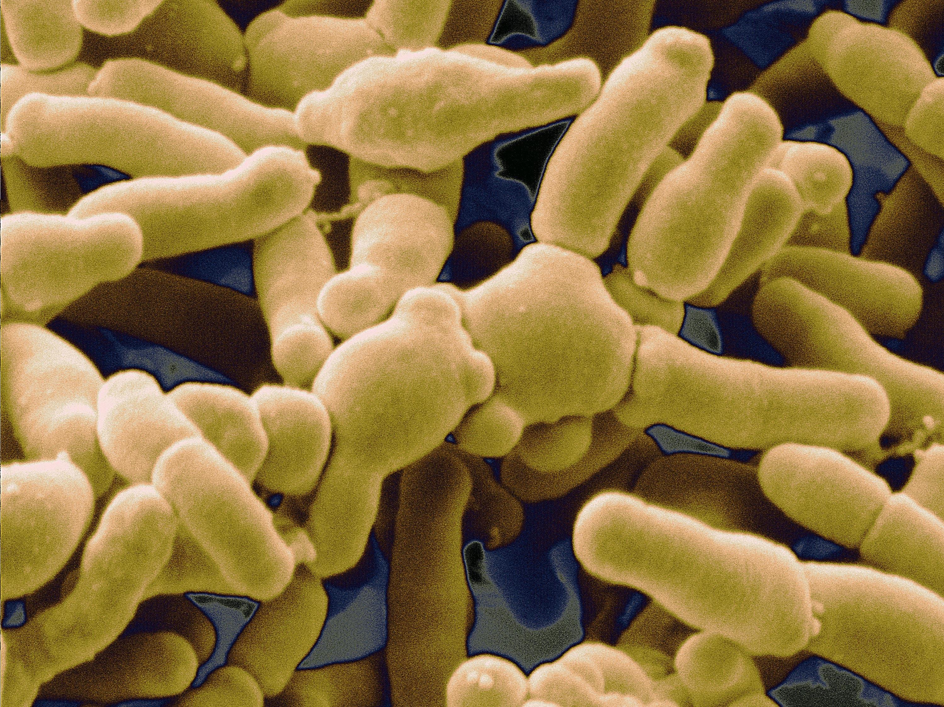 <stamp theme='svt-green1'>Doc. 8</stamp> Bifidobacterium breve, une bactérie présente dans les probiotiques et compléments alimentaires.