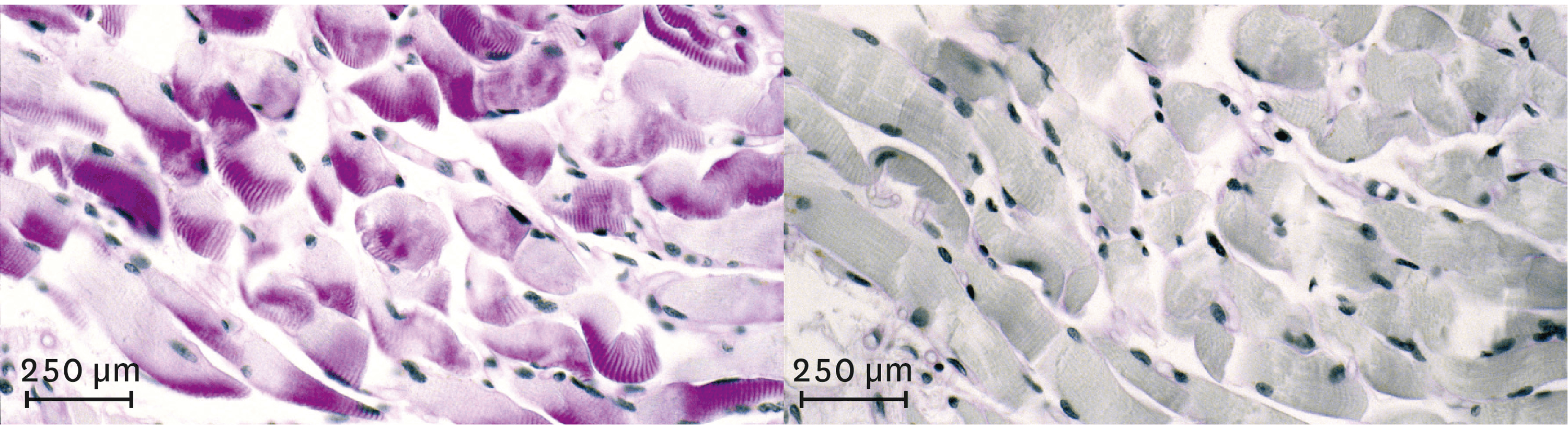 <stamp theme='svt-green1'>Doc. 1</stamp> Observation d’un muscle avant (à gauche) et après (à droite) un effort physique de quelques minutes au microscope optique.