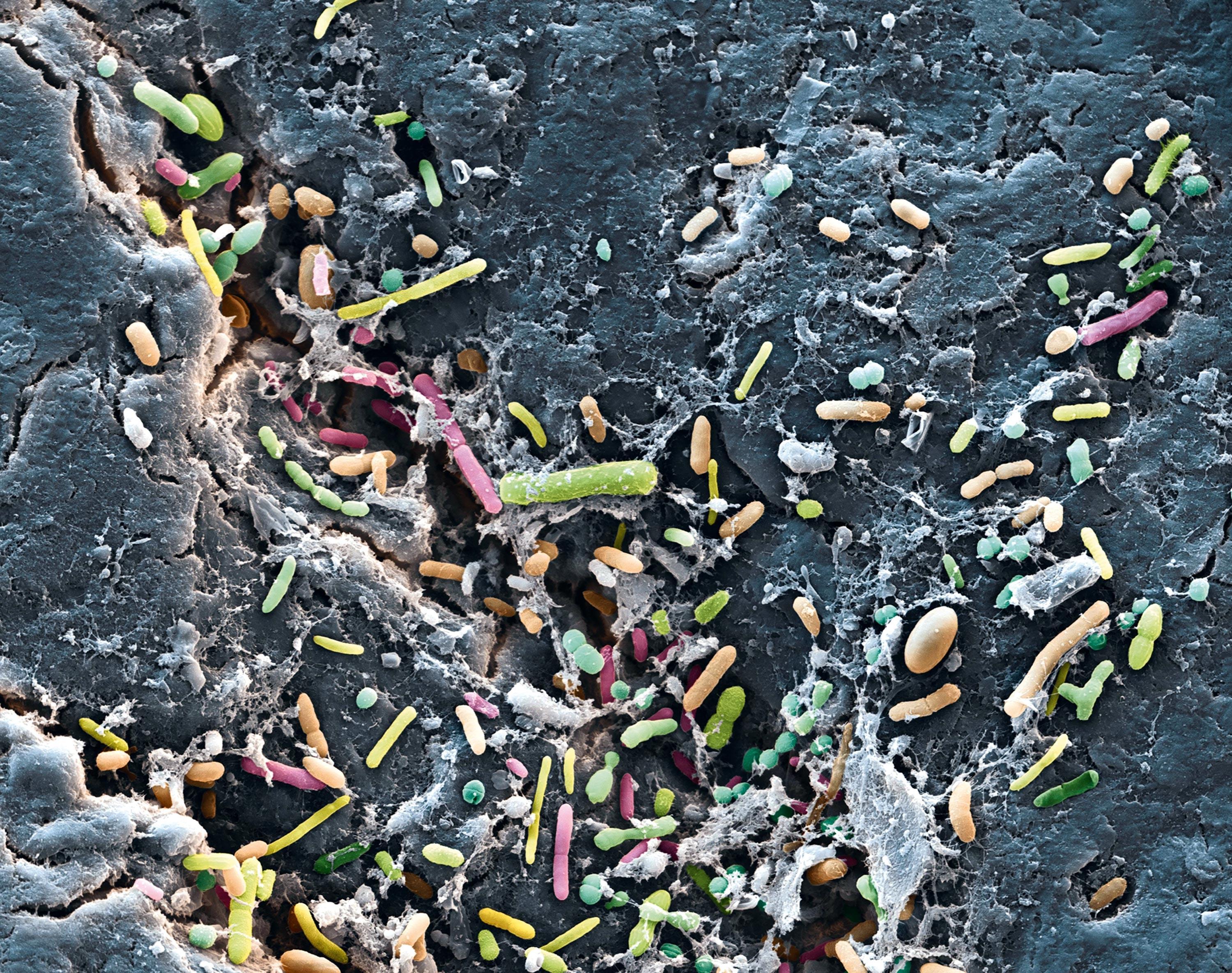 <stamp theme='svt-green1'>Doc. 1</stamp> Des bactéries dans l’intestin humain observées au microscope électronique à balayage (image colorisée).