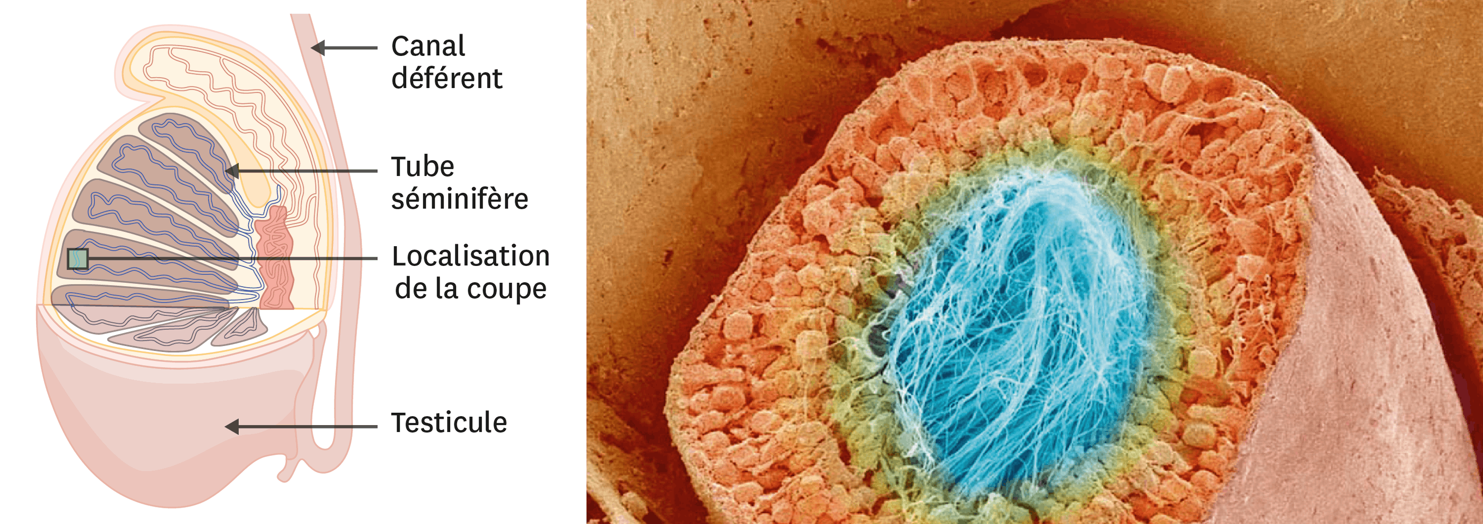 <stamp theme='svt-green1'>Doc. 4</stamp> Une coupe transversale de tube séminifère observée au microscope électronique à balayage (image colorisée).