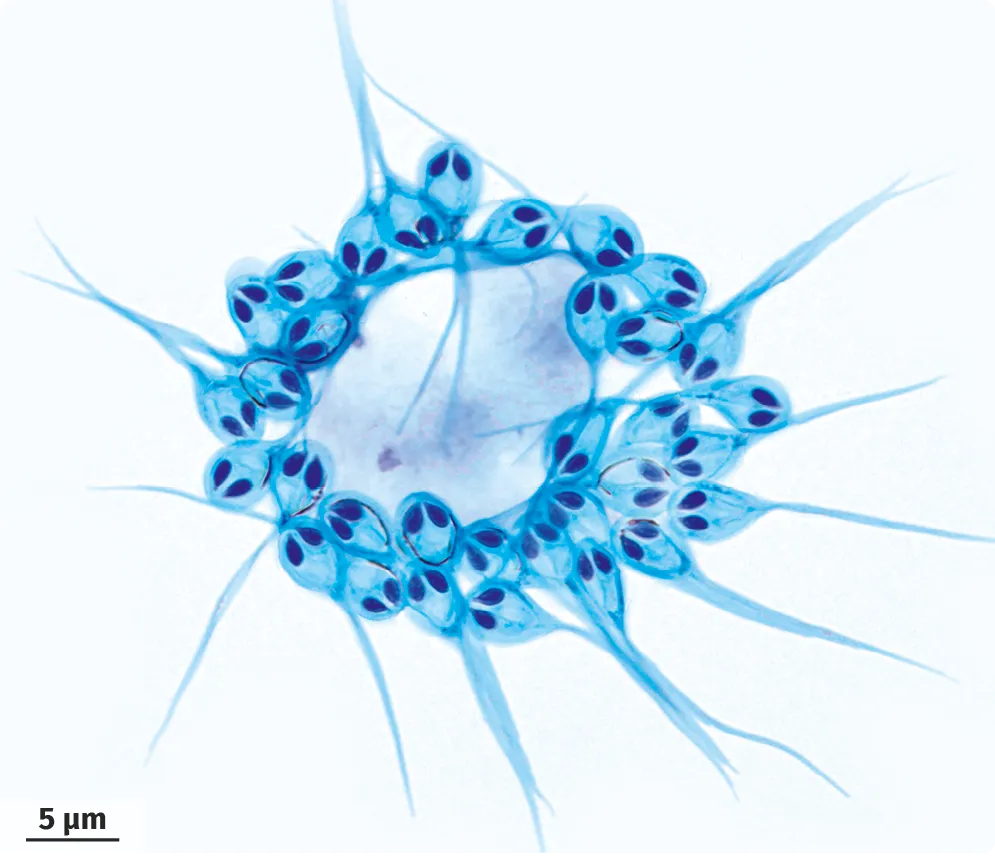 Spores de Henneguya salminicola