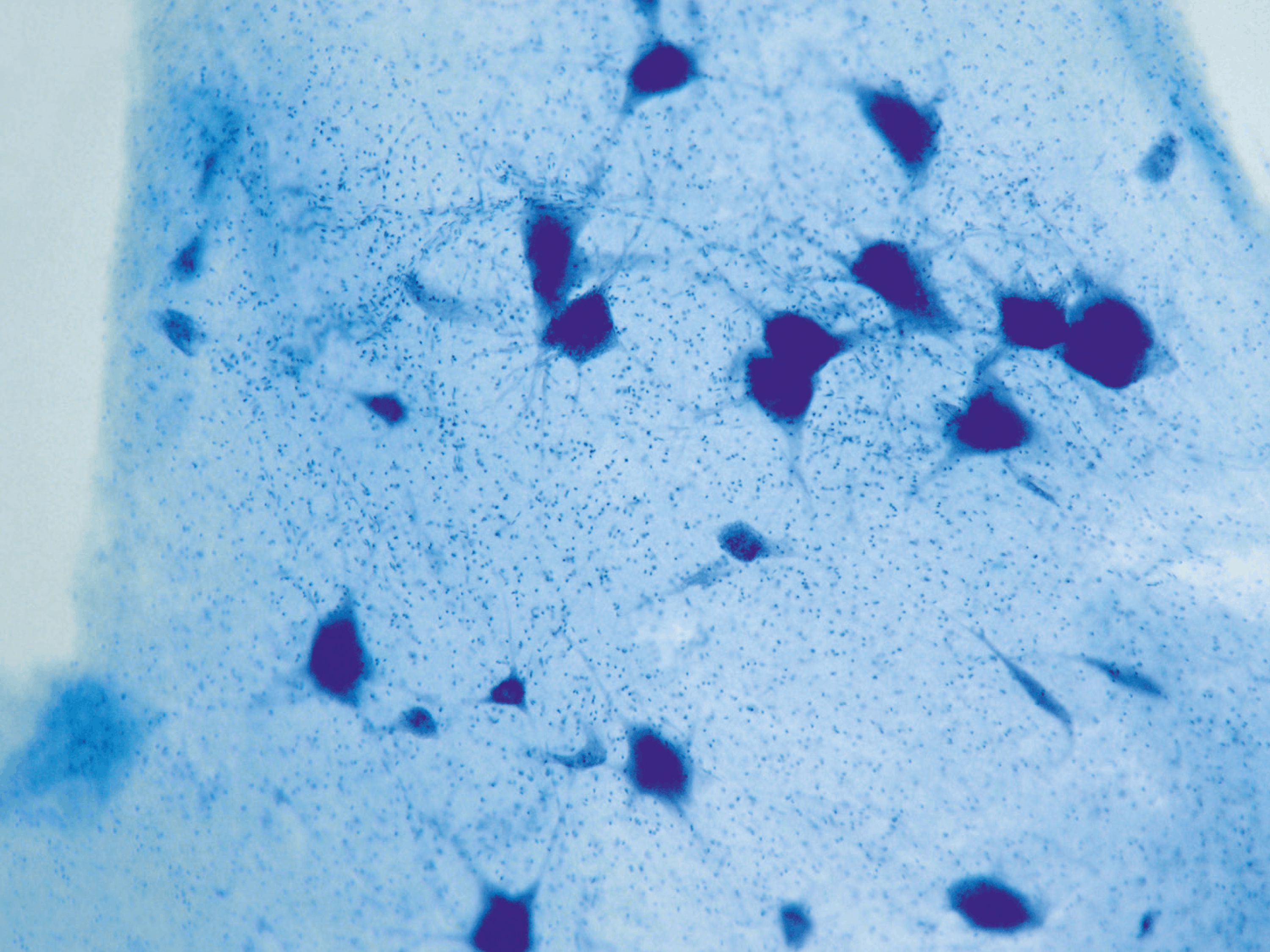 <stamp theme='svt-green1'>Doc. 1</stamp> Photographie de cellules nerveuses humaines vues au microscope optique (x100).