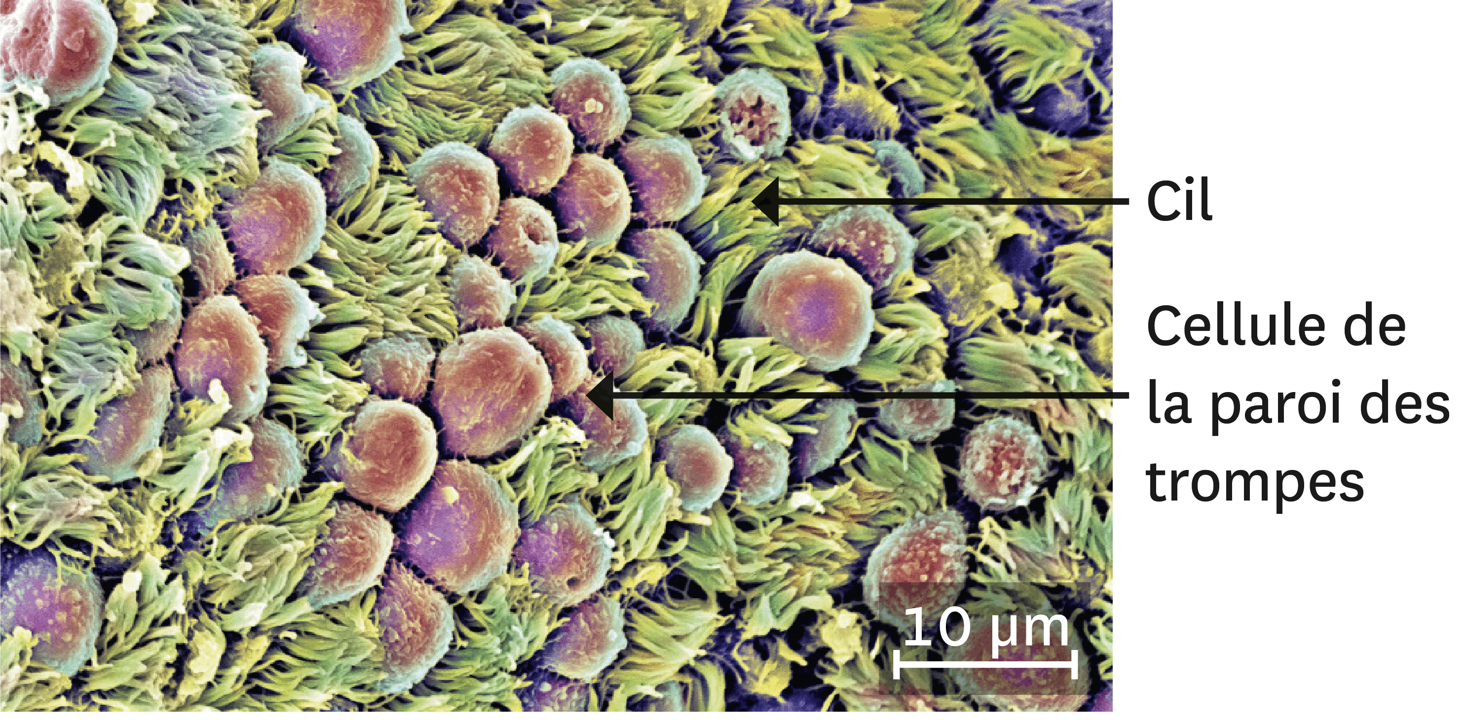 <stamp theme='svt-green1'>Doc. 6</stamp> Une observation au microscope électronique de la paroi des trompes (image colorisée).