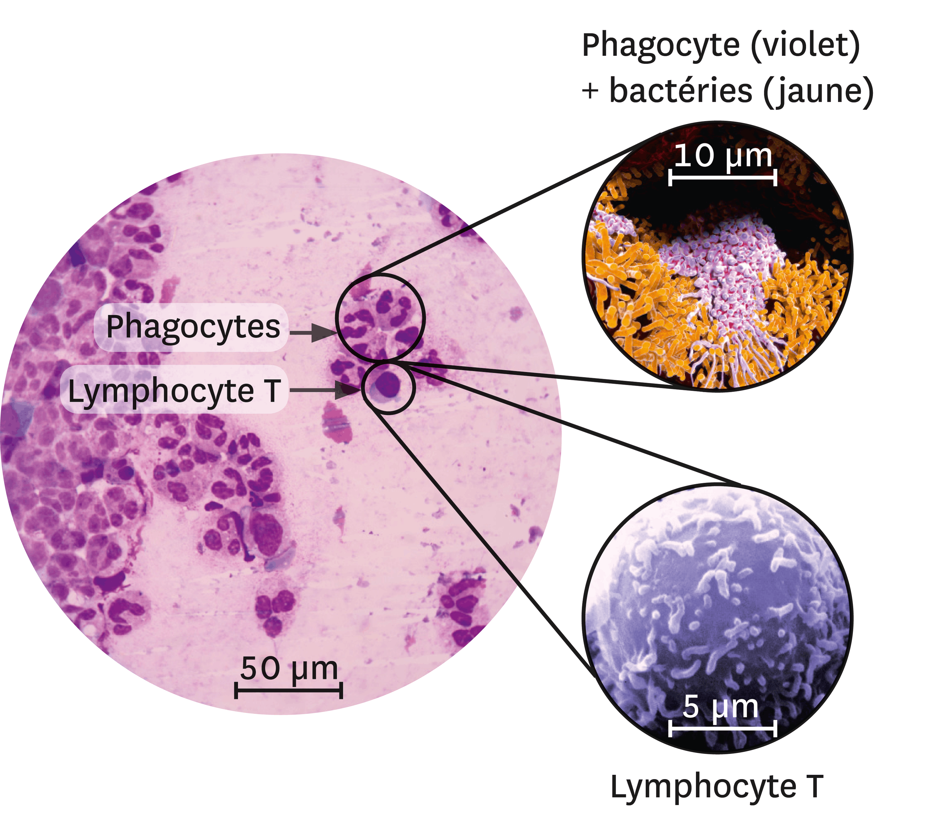 <stamp theme='svt-green1'>Doc. 4</stamp> Différents types de leucocytes sur le site d'une infection.