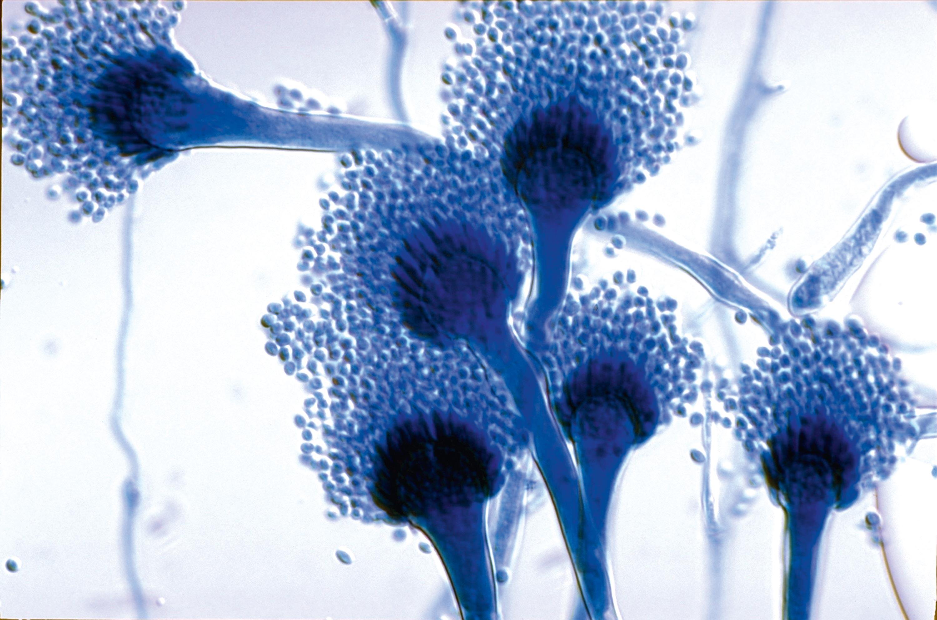 <stamp theme='svt-green1'>Doc. 2</stamp> Un champignon du genre Aspergillus observé au microscope optique.