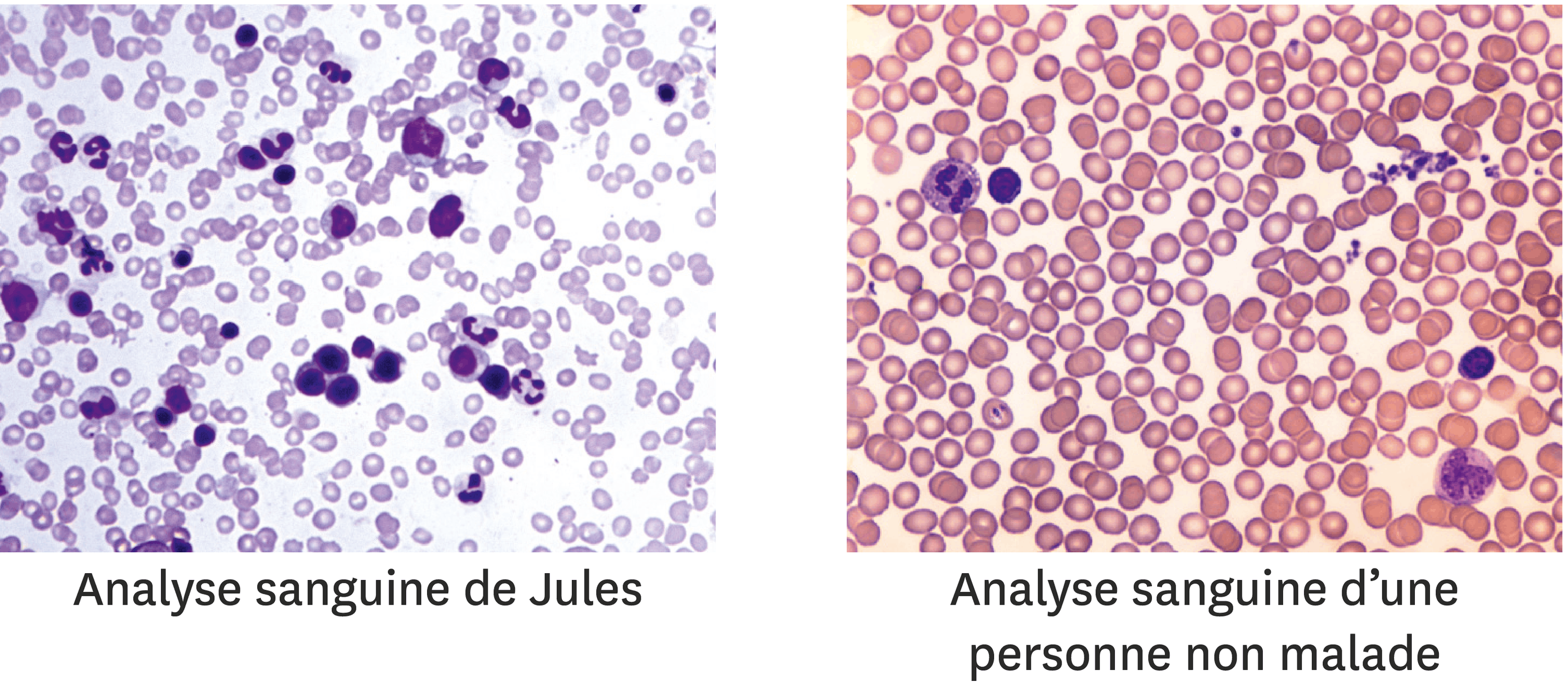 <stamp theme='svt-green1'>Doc. 1</stamp> La comparaison du sang de Jules avec celui d’une personne non malade.