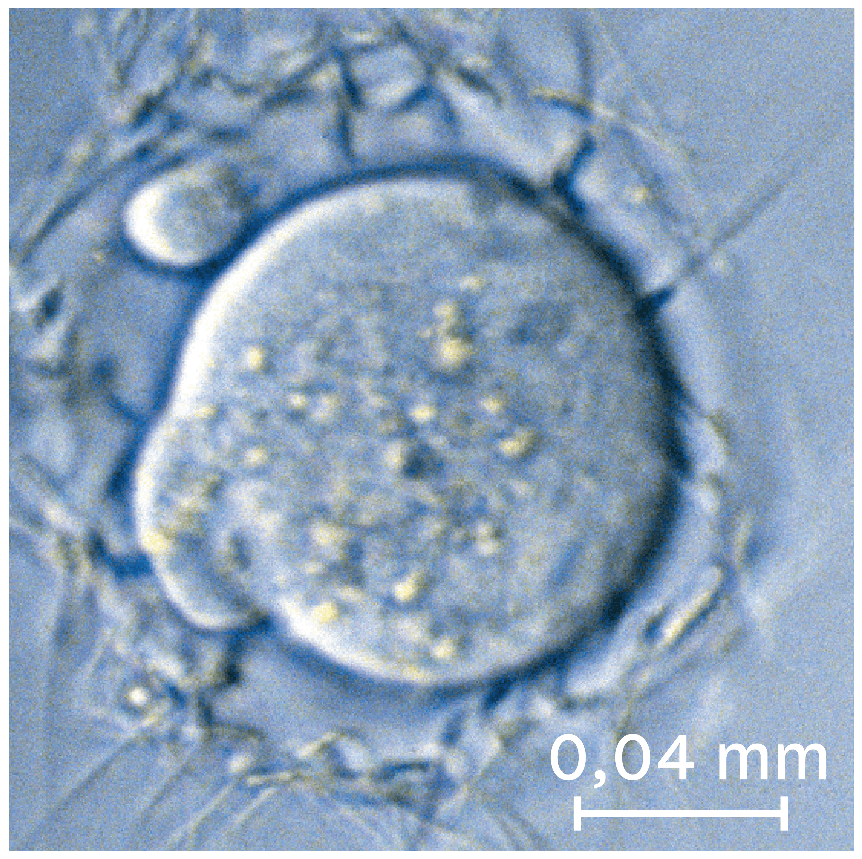 <stamp theme='svt-green1'>Doc. 5</stamp> Un ovule observé au microscope optique.