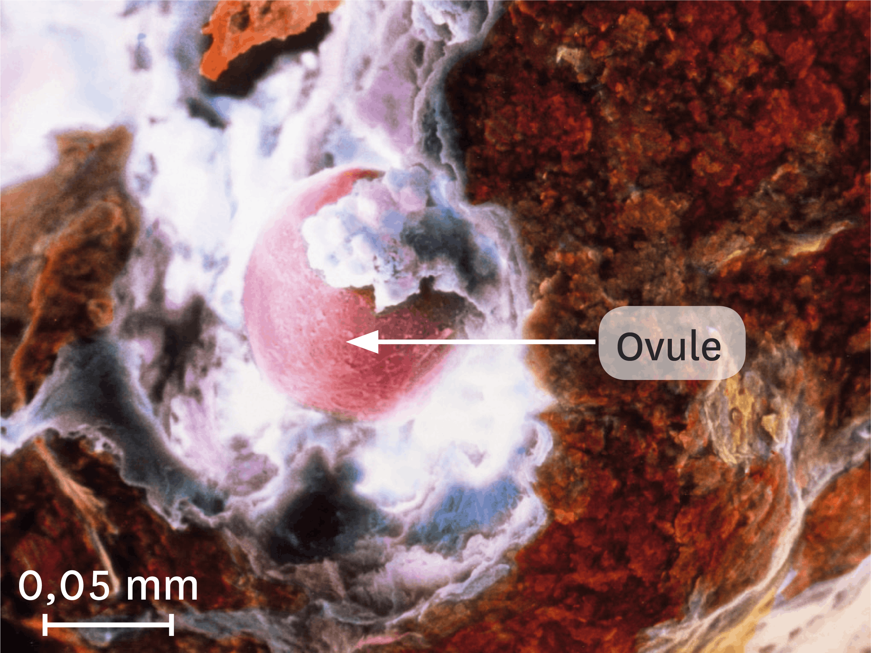 <stamp theme='svt-green1'>Doc. 5</stamp> Une ovulation observée au microscope électronique à balayage (image colorisée).