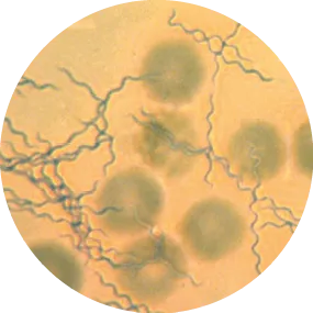 Bactéries Borrelia
vues au microscope