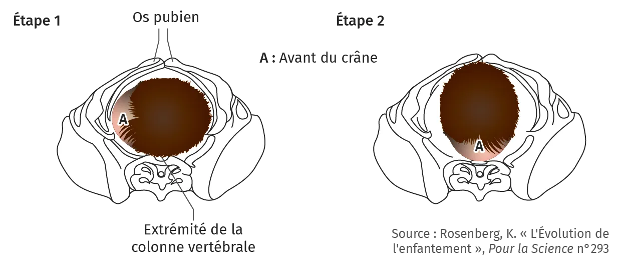 La rotation intra-pelvienne de la tête du bébé humain au cours de l'accouchement