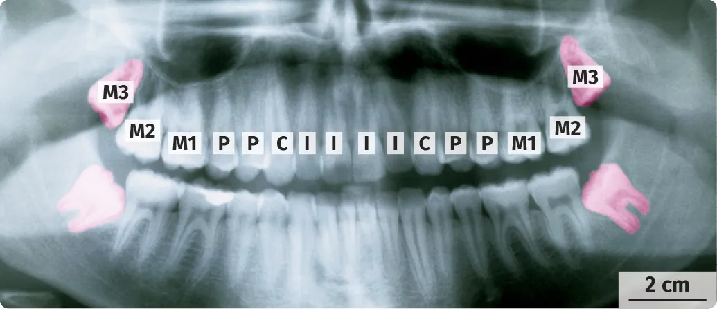 Radiographie des dents chez l'être humain adulte