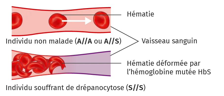 Schéma des hématies