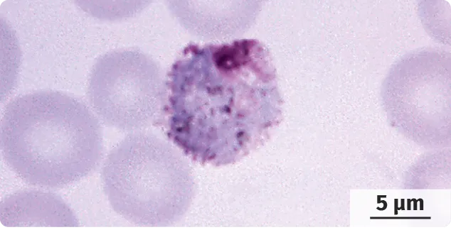 Plasmodium vivax