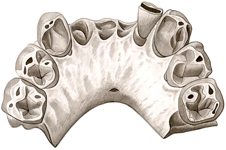 Mandibule d'Abel