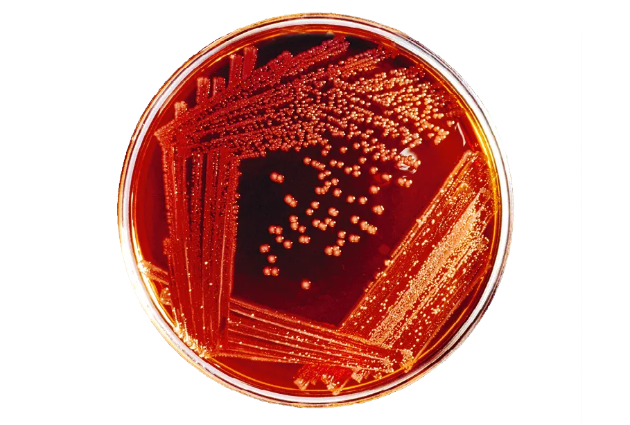 Colonies de bactéries dans une boîte de Petri