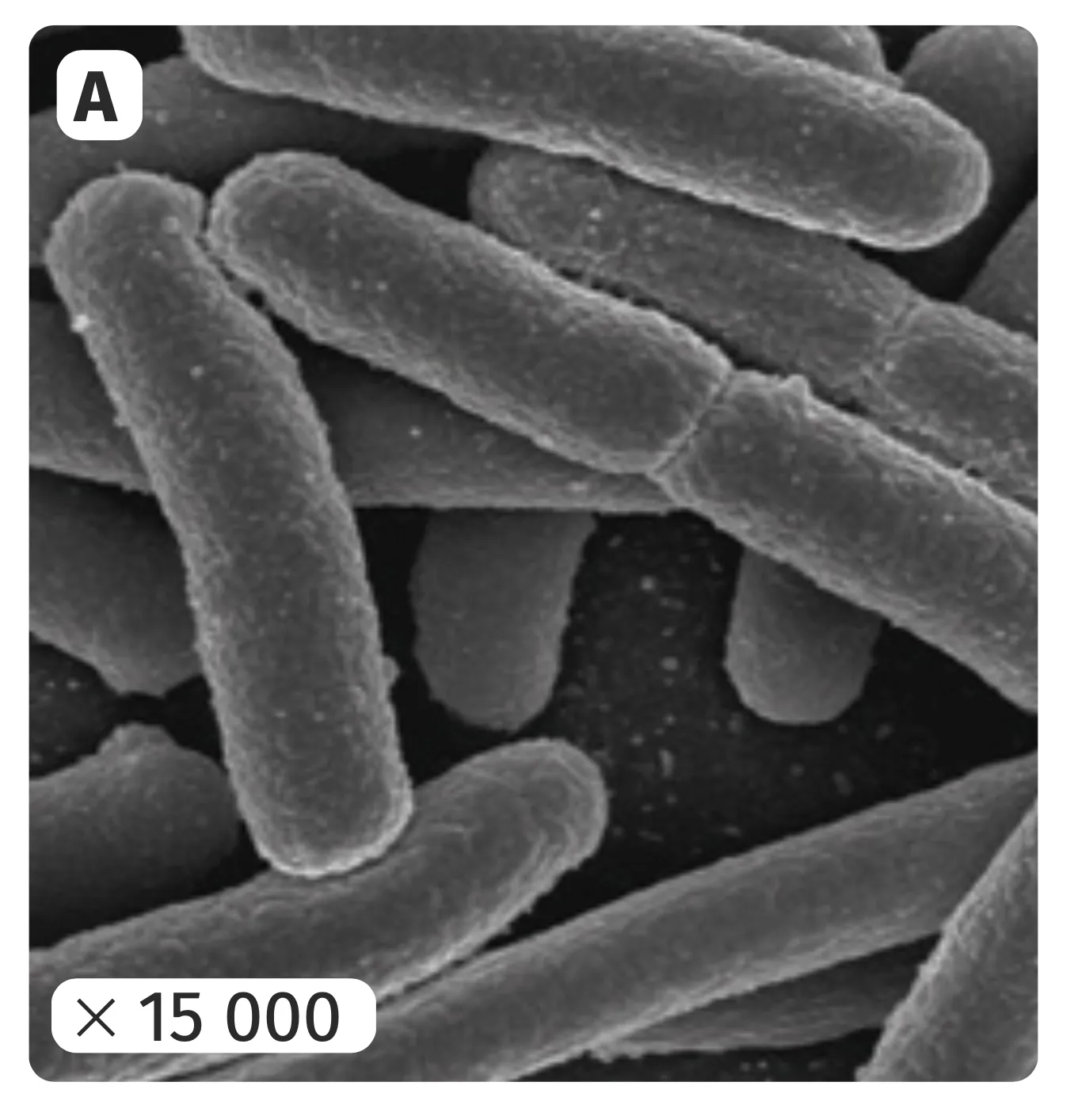 Photo A des bactéries Escherichia coli