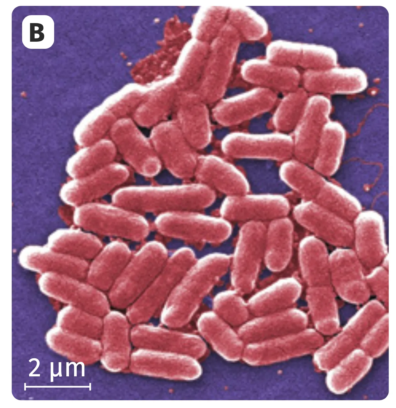 Photo B des bactéries Escherichia coli