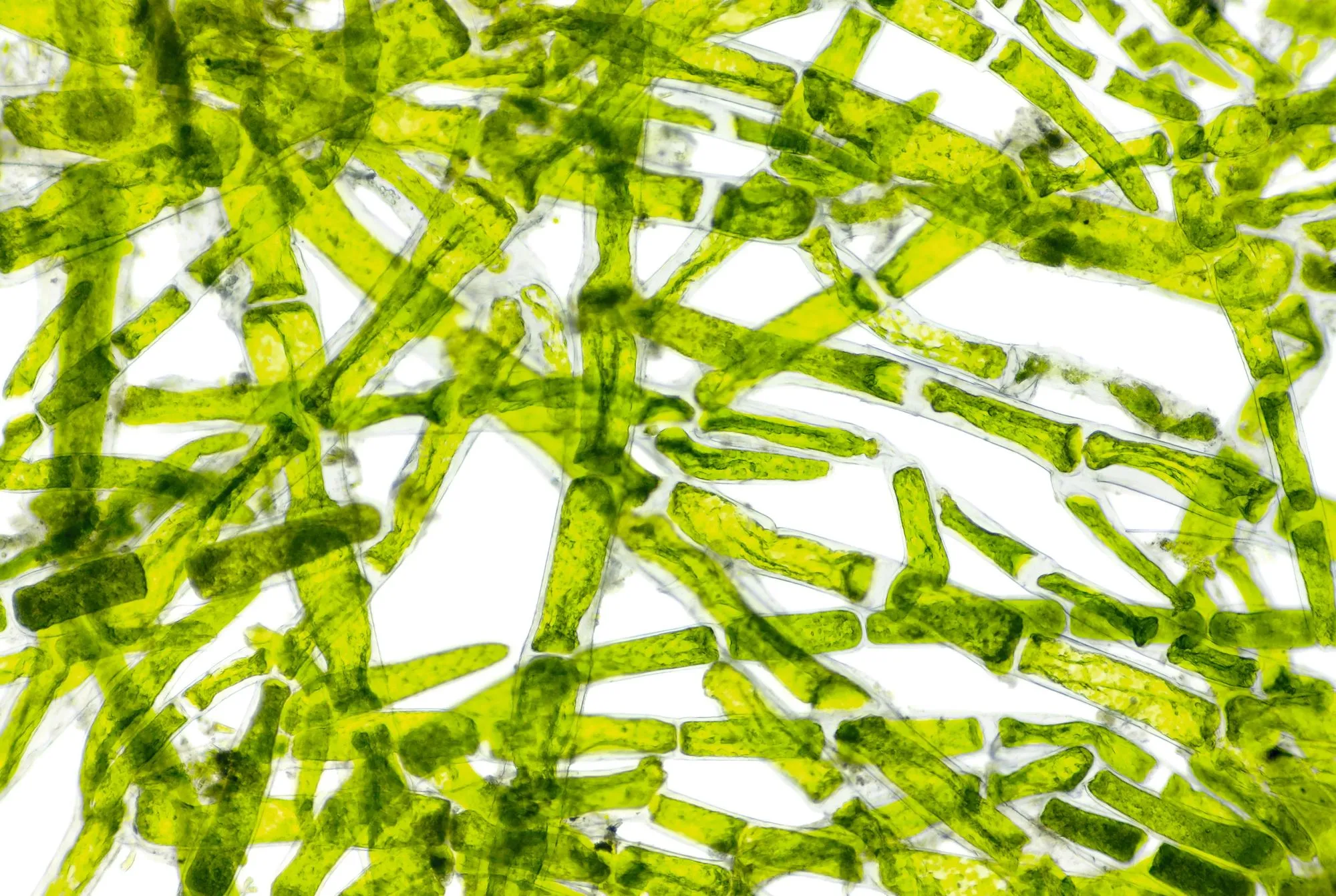 Cellules de cladophore, une algue verte, vues au microscope.