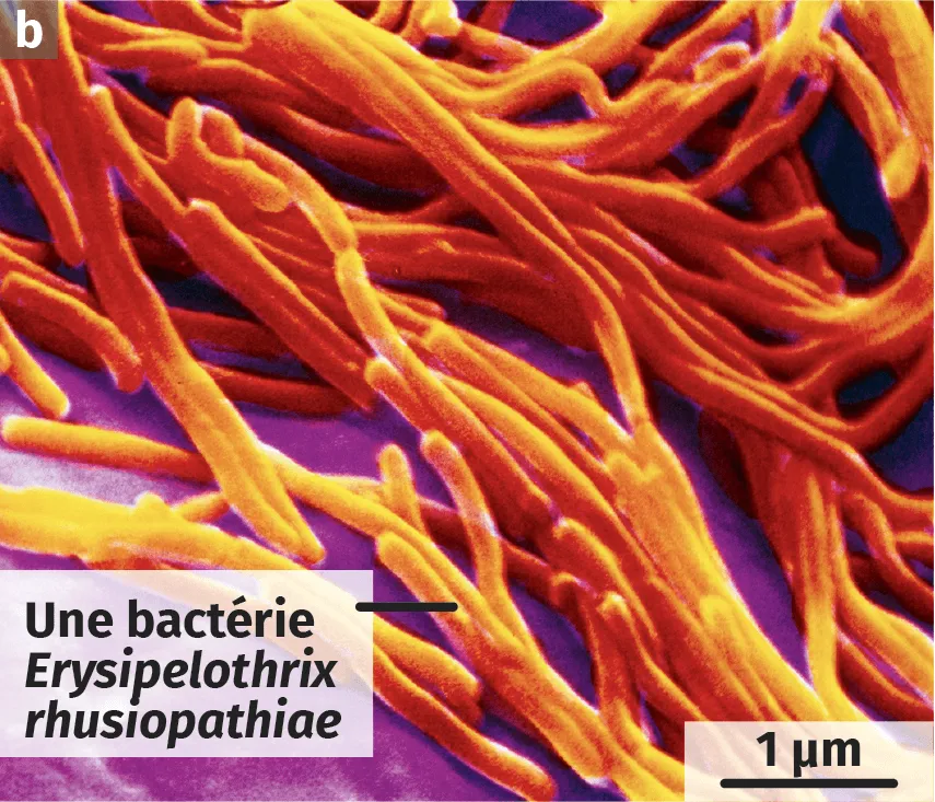 La bactérie Erysipelothrix rhusiopathiae, Observation récente au microscope électronique à balayage (image colorisée).