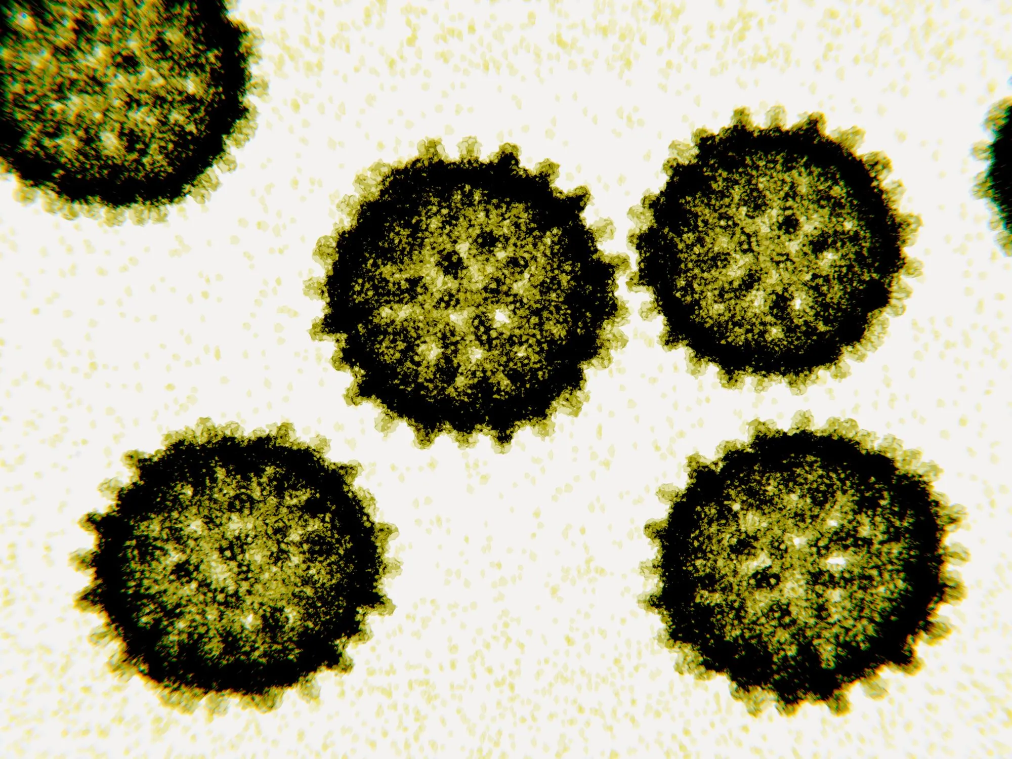 Photographie du virus responsable de l'Hépatite C