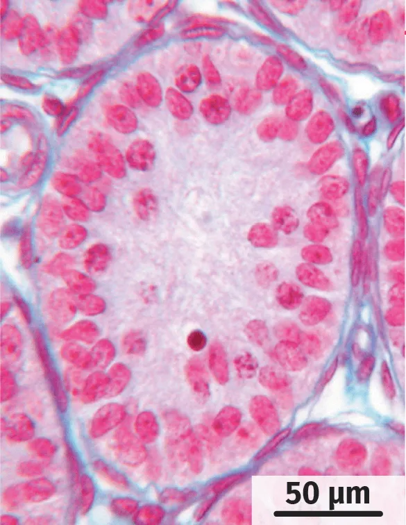 Coupe transversale de tube séminifère de souris mâle après inactivation du récepteur à la testostérone.