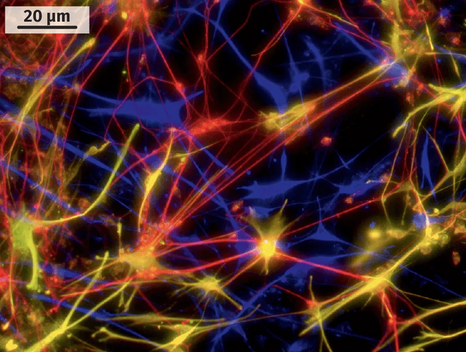 Neurones dérivés de cellules souches embryonnaires et obtenus en laboratoire.