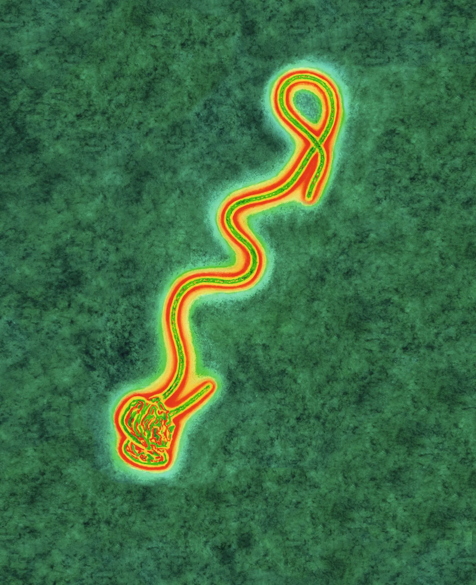 Virus Ebola (MET, image colorisée)