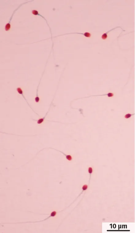 Observation au microscope optique du sperme de M. A.