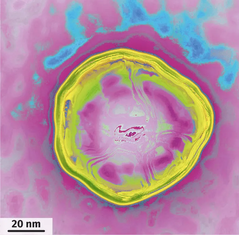 observation au MET, image colorisée, d'une hépatite B.