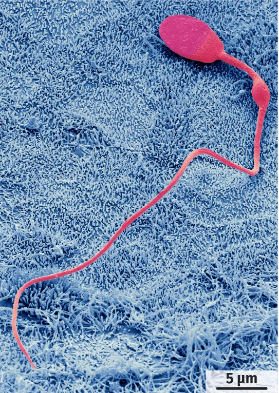 Spermatozoïde humain observé en microscopie électronique à balayage (image colorisée).
