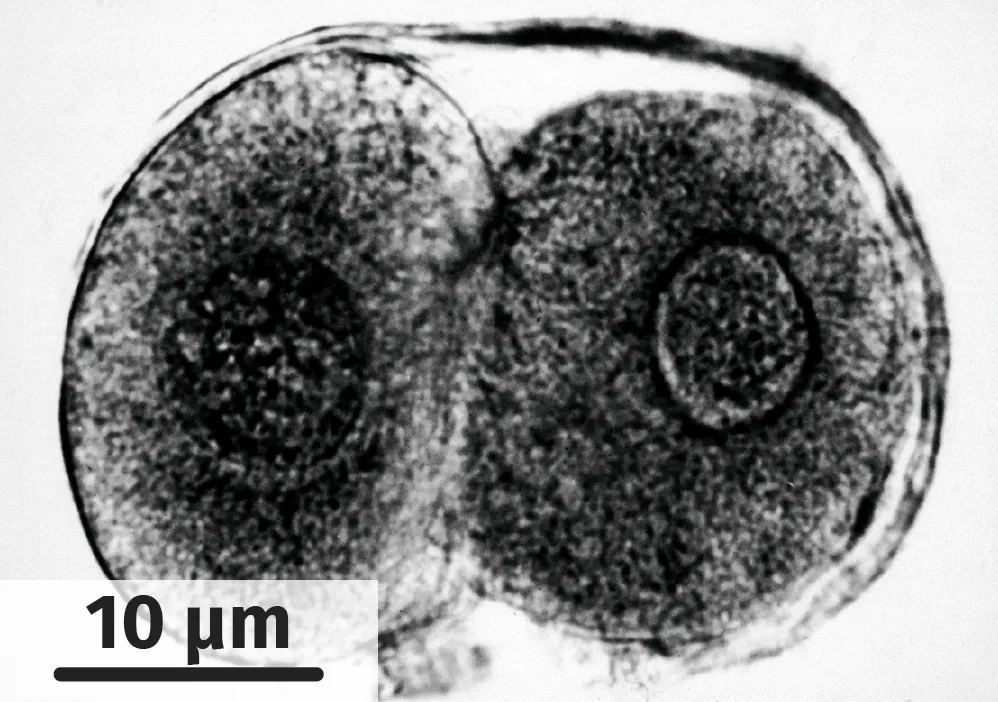 Embryon humain de 48 heures, au stade deux cellules, observé au MET