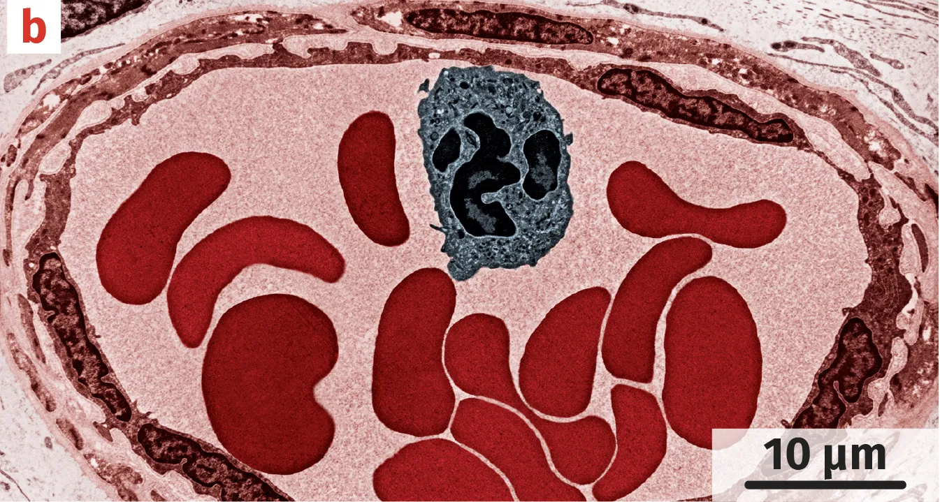Coupe transversale de vaisseau sanguin