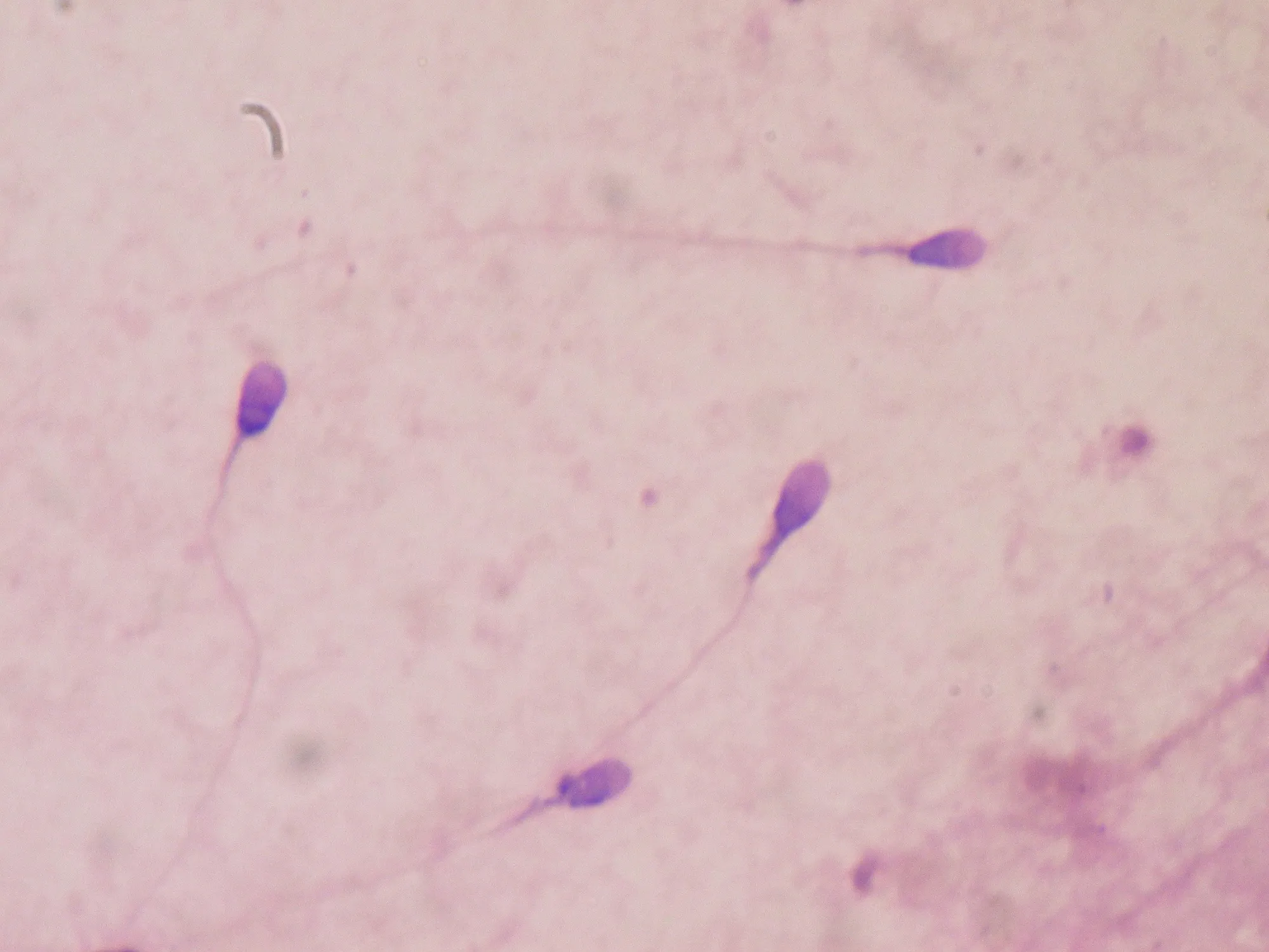 Photographie de cellules reproductrices observées au microscope optique