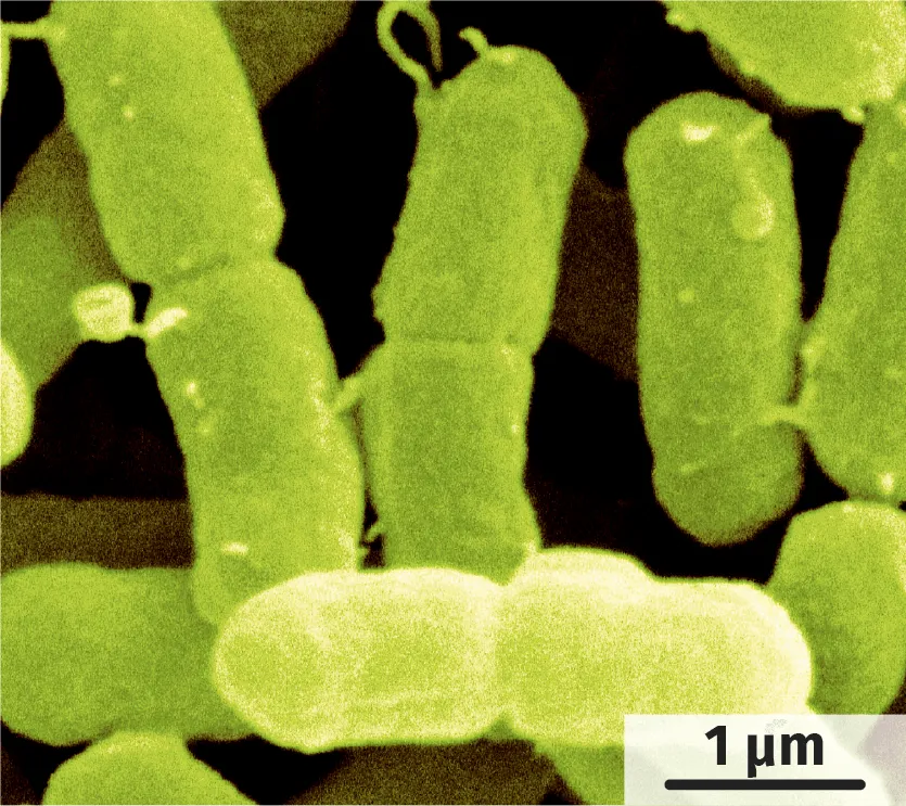  Bactéries Escherichia coli et Enterobacter sakazii observées au microscope électronique à balayage 