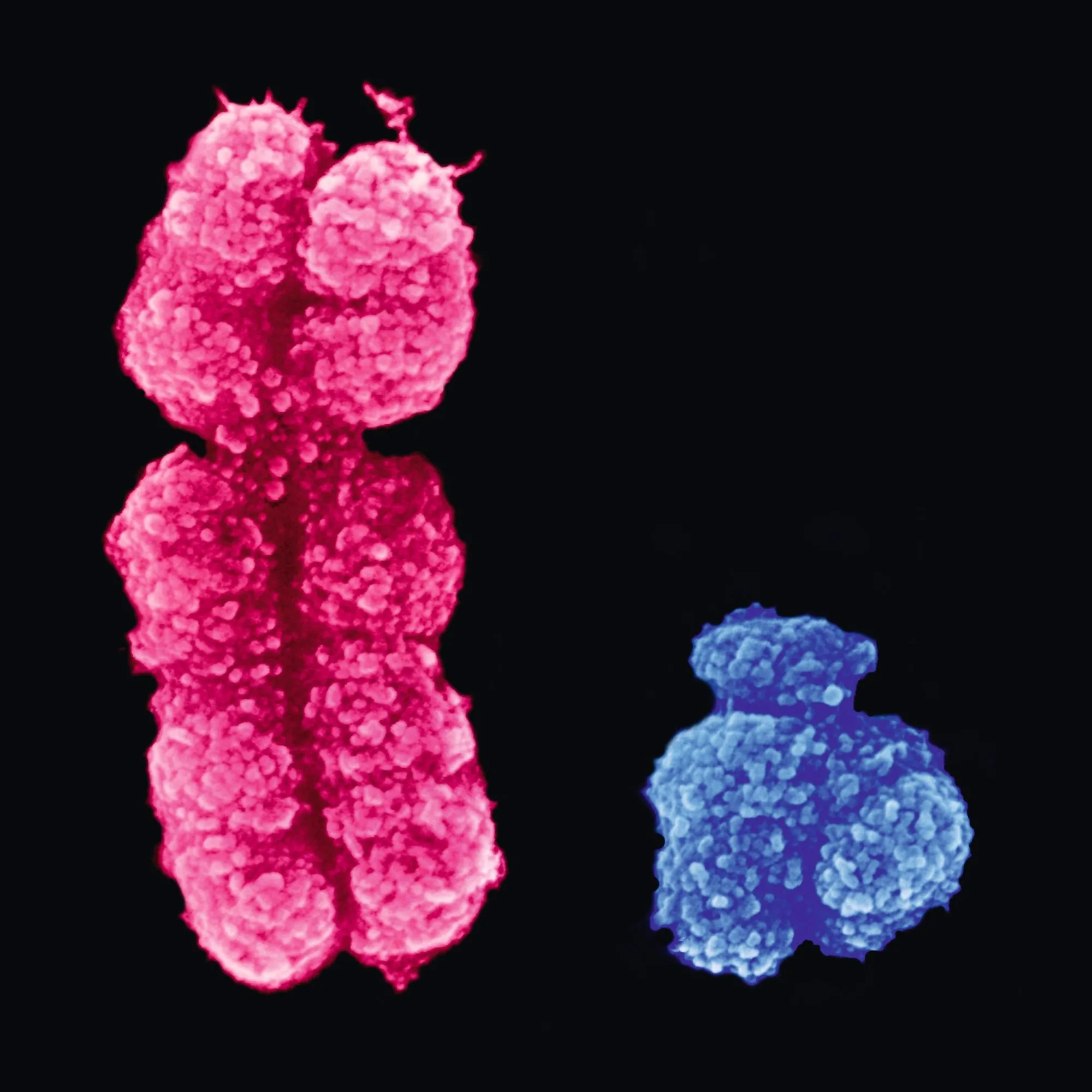 Chromosomes sexuels humains observés au microscope électronique à balayage (X à gauche et Y à droite).