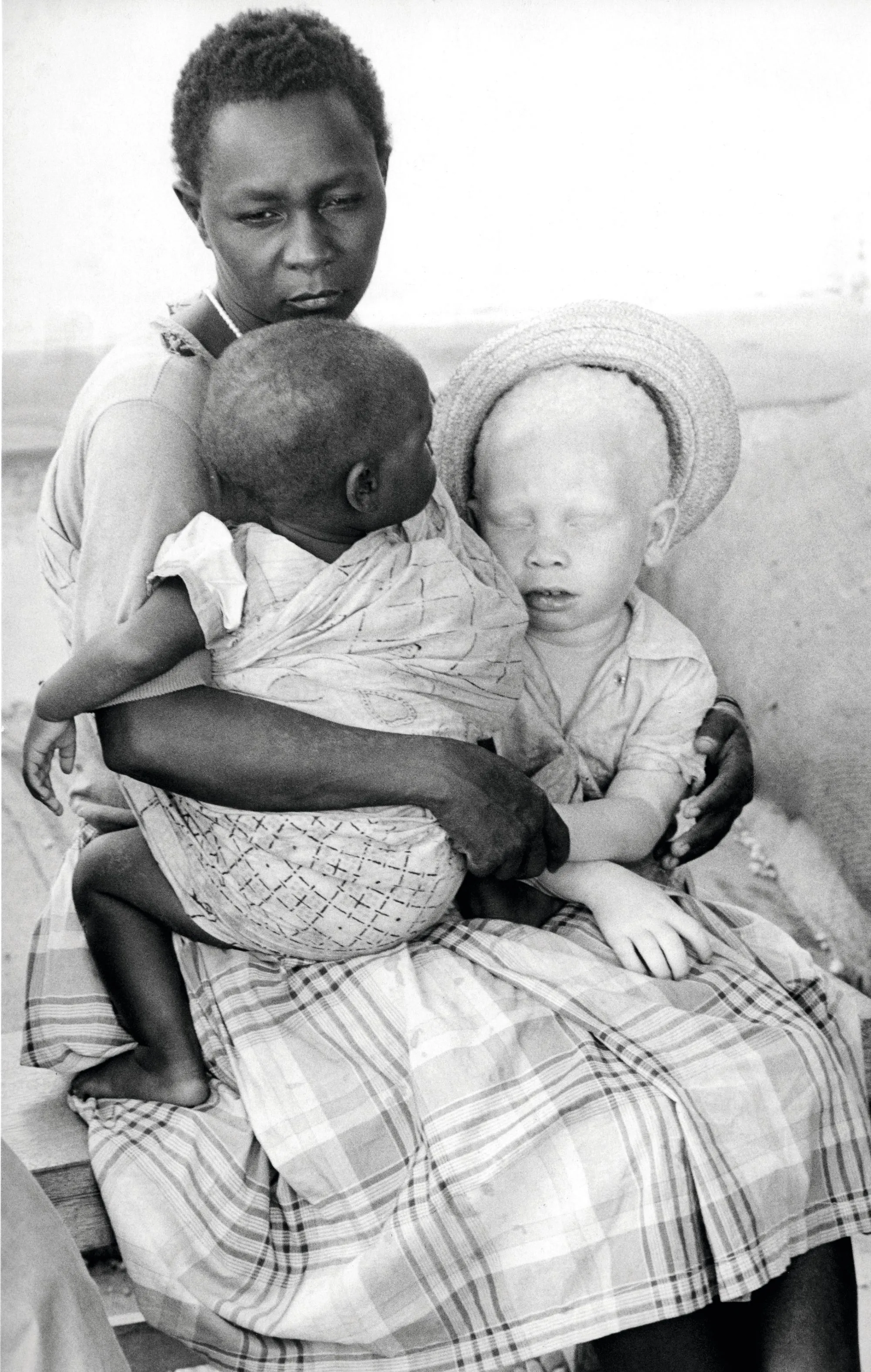 Une mère et ses deux enfants, dont un albinos