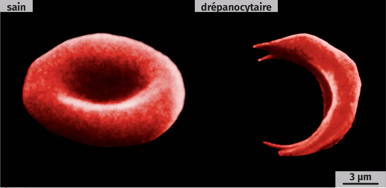 Globules rouges (MEB, images colorisées)