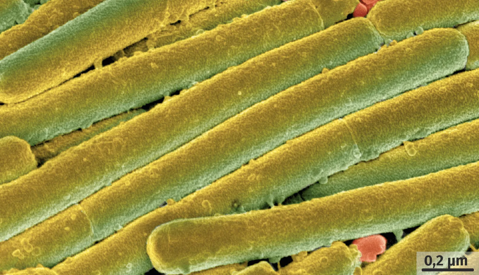 La bactérie Clostridium difficile observée au microscope électronique à balayage