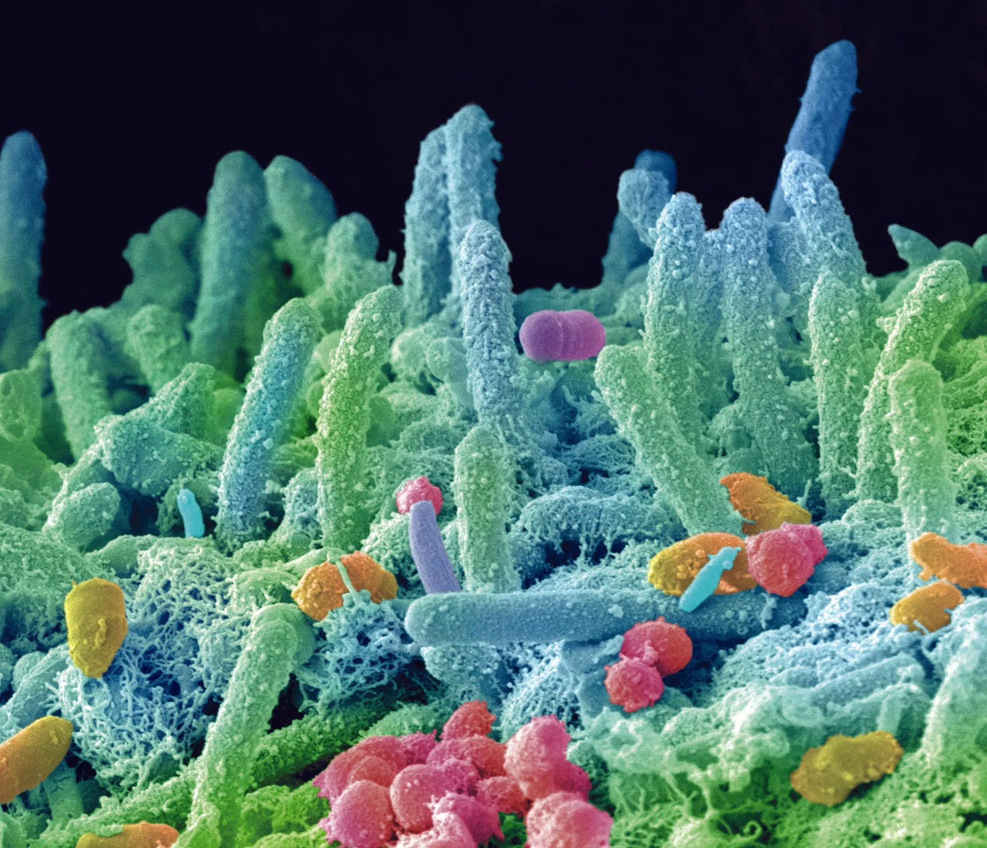 Microorganismes de la bouche observés au microscope électronique à balayage