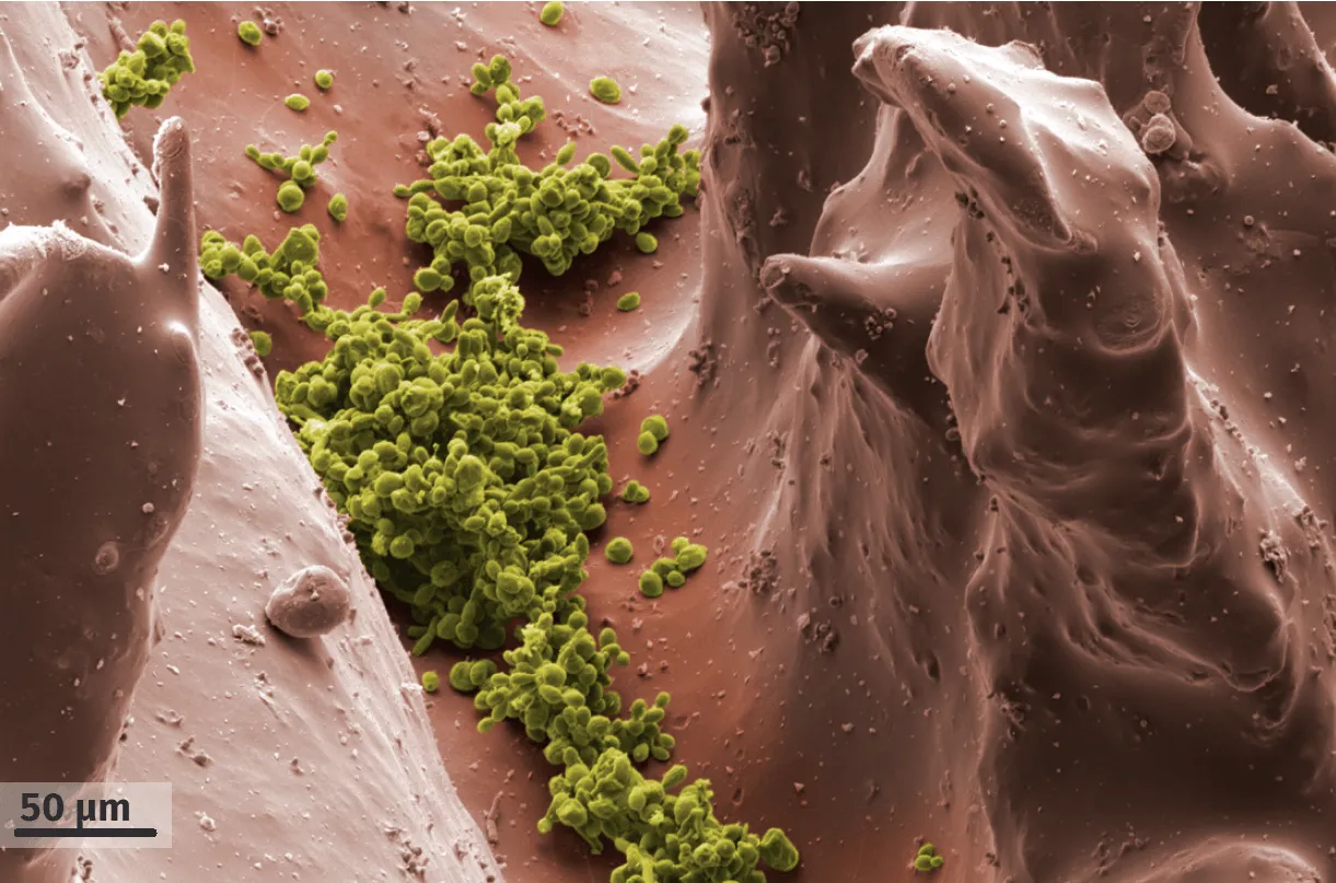 Observation au microscope électronique à balayage de Candida albicans à la surface de la langue