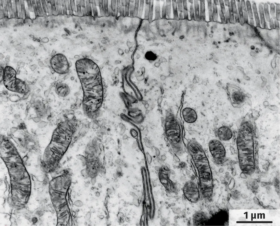 Cellules d'un intestin observées au microscope électronique à transmission
