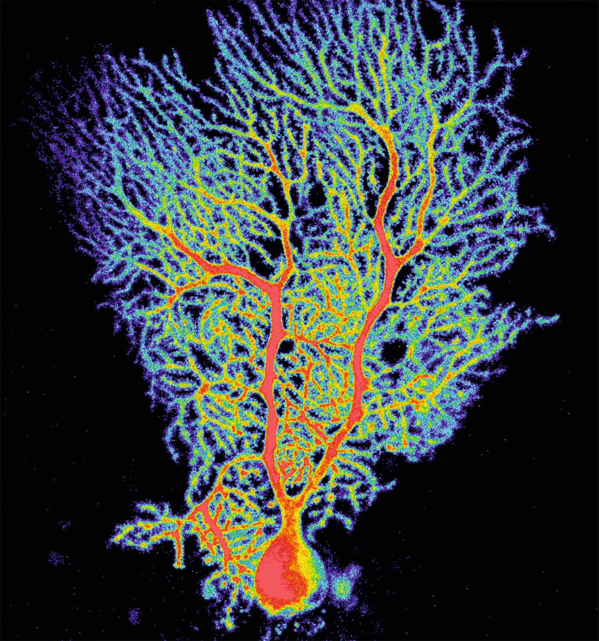 Neurones du cervelet, zone située à l'arrière du cerveau.